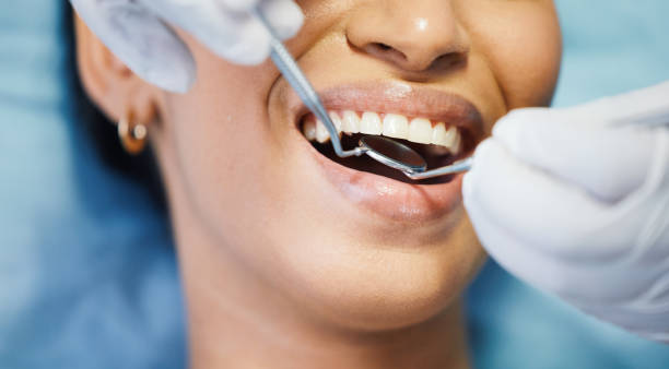 Best Walk-In Emergency Dentist in Potosi, MO