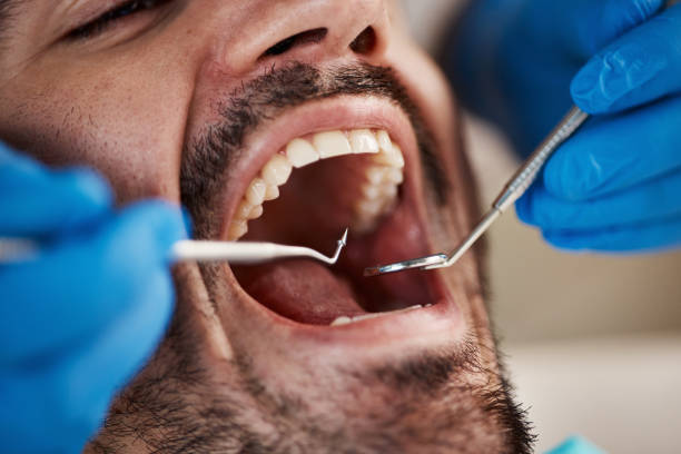 Best Emergency Broken Tooth Repair in Potosi, MO