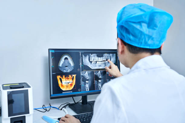Best Emergency Wisdom Teeth Removal in Potosi, MO